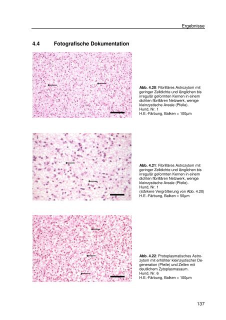 Immunhistologische Charakterisierung primärer Neoplasien des ...