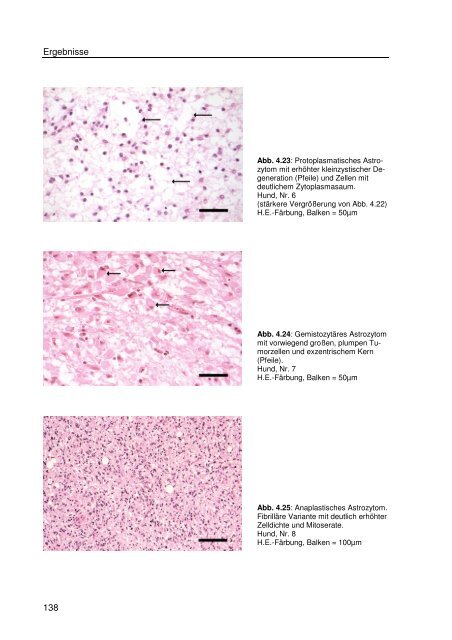 Immunhistologische Charakterisierung primärer Neoplasien des ...