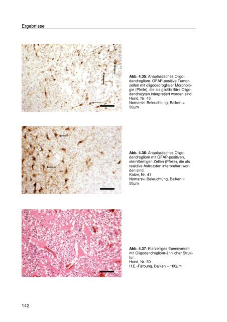 Immunhistologische Charakterisierung primärer Neoplasien des ...