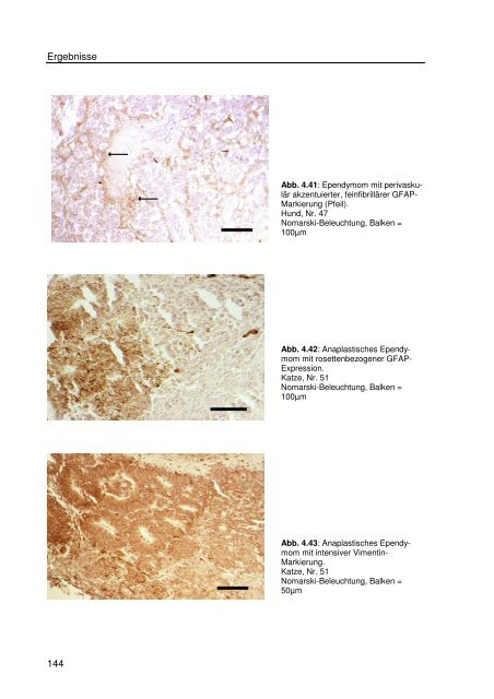 Immunhistologische Charakterisierung primärer Neoplasien des ...