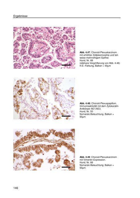 Immunhistologische Charakterisierung primärer Neoplasien des ...