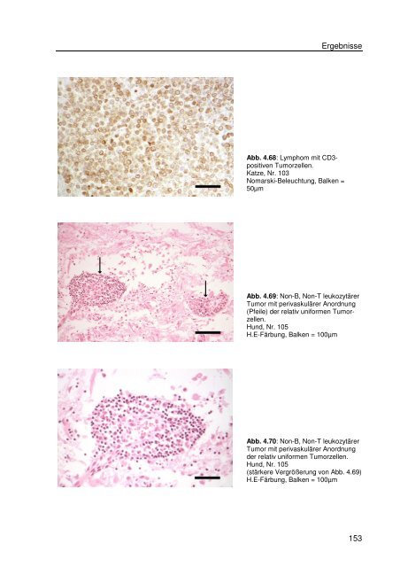 Immunhistologische Charakterisierung primärer Neoplasien des ...