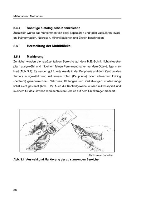 Immunhistologische Charakterisierung primärer Neoplasien des ...