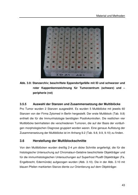 Immunhistologische Charakterisierung primärer Neoplasien des ...