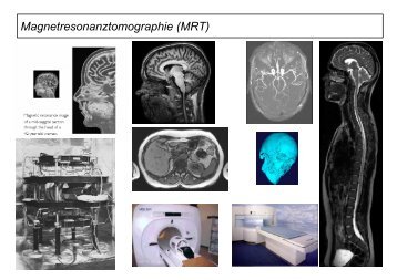 Magnetresonanztomographie (MRT)