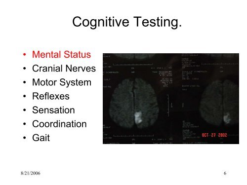 Cognitive Testing: Achilles Heel of Clinical Neurology - USF Health