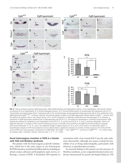 Novel FGF8 Mutations Associated with Recessive ...