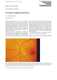 The fundus in malignant hypertension.