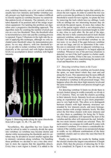 Automatic Vertebra Detection in X-Ray Images - Faculdade de ...