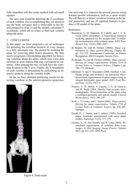 Automatic Vertebra Detection in X-Ray Images - Faculdade de ...