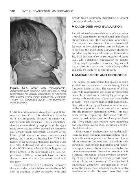 Congenital malformations - Edocr