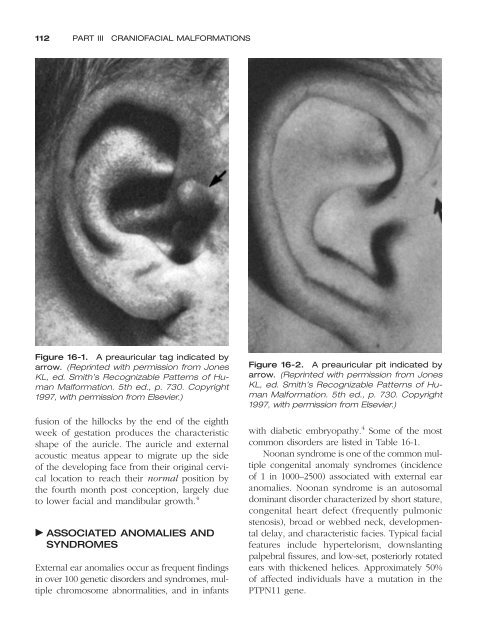 Congenital malformations - Edocr