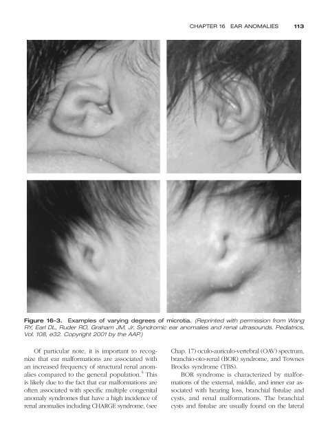 Congenital malformations - Edocr