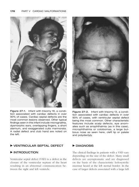 Congenital malformations - Edocr