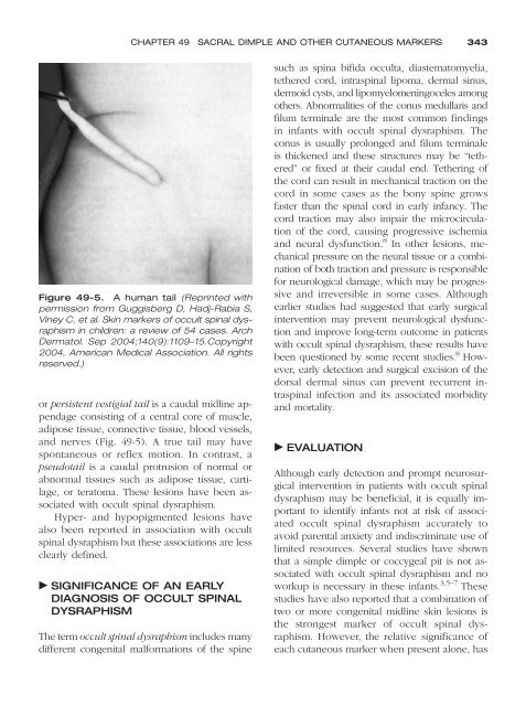 Congenital malformations - Edocr