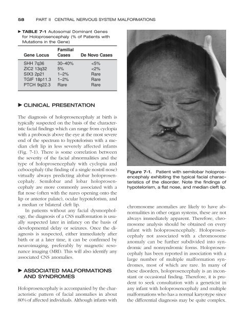 Congenital malformations - Edocr