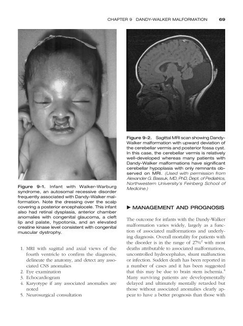 Congenital malformations - Edocr