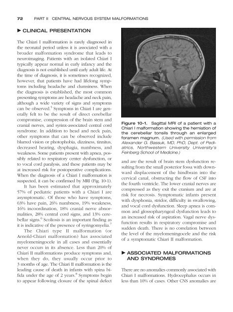 Congenital malformations - Edocr