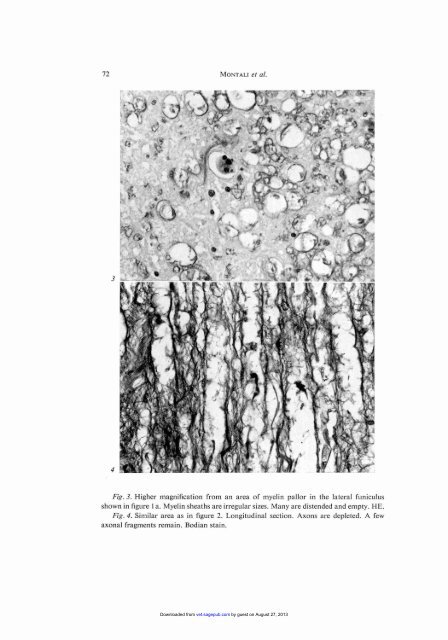 Spinal Ataxia in Zebras