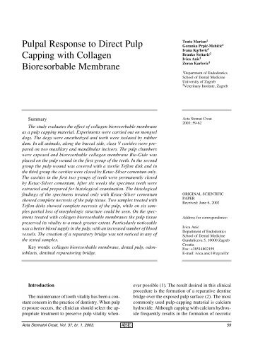 Pulpal Response to Direct Pulp Capping with Collagen ...