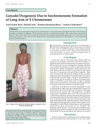 Gonadal Dysgenesis Due to Isochromosome Formation of Long Arm ...