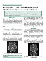 Atrial Myxoma : A Rare Cause of Ischemic Stroke