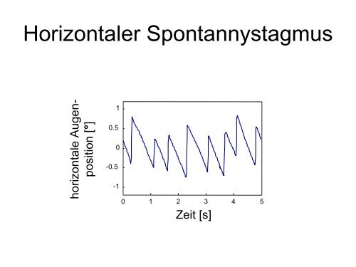 Diagnostik & Therapie des Schwindels