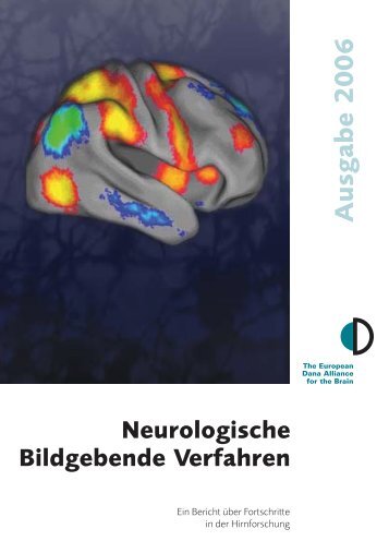 Neurologische Bildgebende Verfahren - Dana Foundation