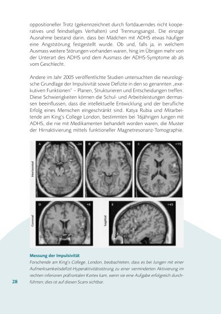 Neurologische Bildgebende Verfahren - Dana Foundation