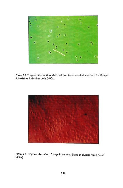 in vitro culture and isoenzyme analysis of giardia lamblia