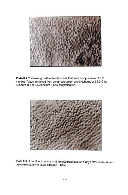 in vitro culture and isoenzyme analysis of giardia lamblia