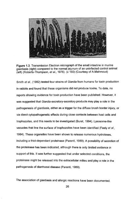 in vitro culture and isoenzyme analysis of giardia lamblia