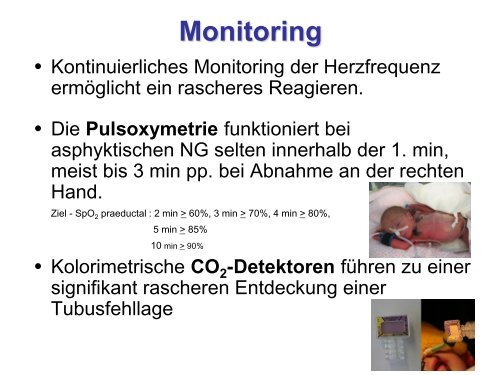 Erstversorgung und Reanimation des Neugeborenen