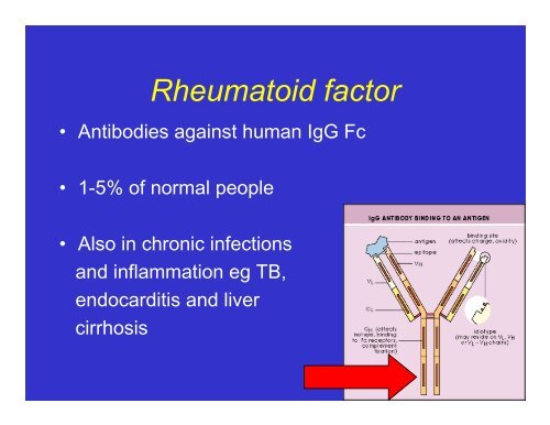 Rheumatoid Arthritis