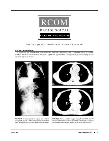 Download PDF - Applied Radiology Online