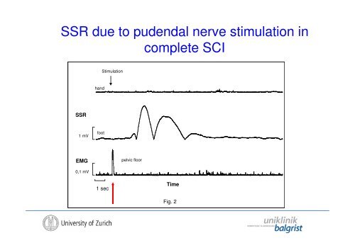 The Autonomic Nervous System in Human SCI - Uniklinik Balgrist