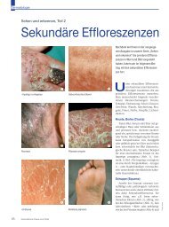 Sekundäre Effloreszenzen - Beauty Forum