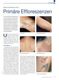 Primäre Effloreszenzen - Beauty Forum