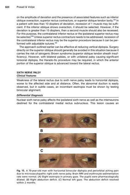 Paralytic Strabismus: Third, Fourth, and Sixth Nerve Palsy