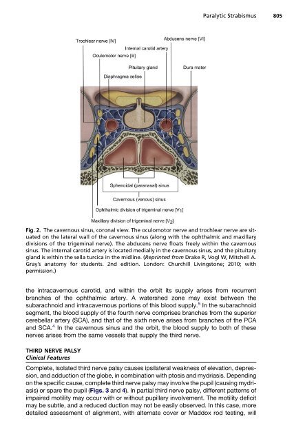 Paralytic Strabismus: Third, Fourth, and Sixth Nerve Palsy