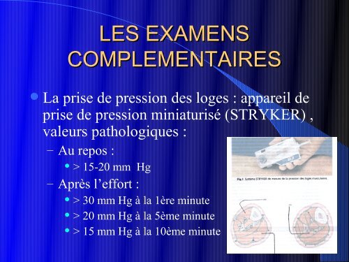 LES SYNDROMES CHRONIQUES DE LOGES