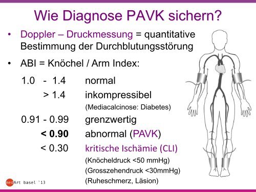 Periphere arterielle Verschlusskrankheit (PAVK)