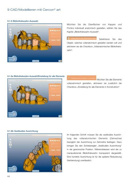 Cercon art 3.2 Gebrauchsanweisung - DeguDent GmbH