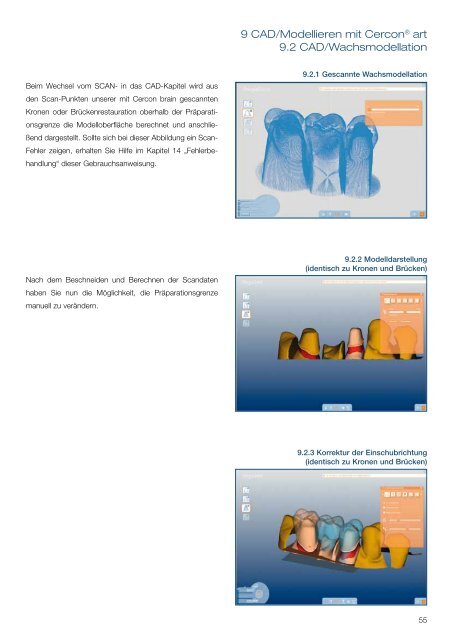 Cercon art 3.2 Gebrauchsanweisung - DeguDent GmbH