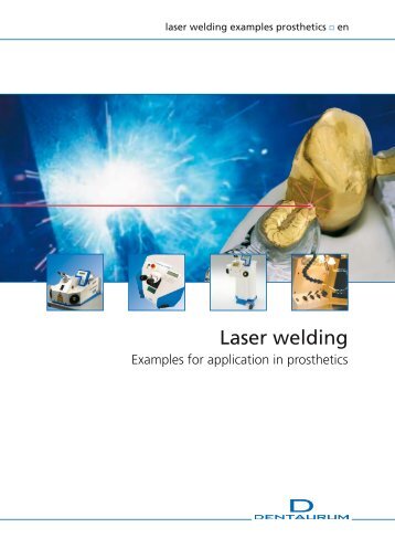 Laser welding - Examples for application in ... - DENTAURUM