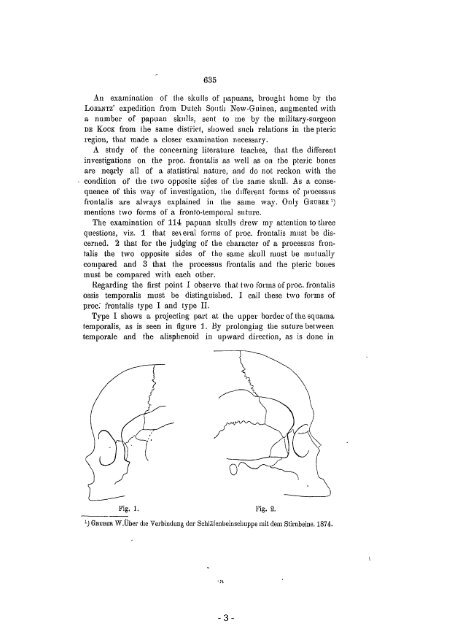 On pteric sutures and pteric bones in the human skull - DWC - KNAW