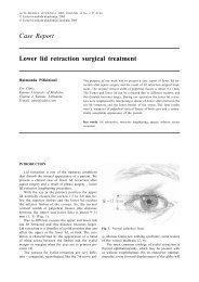 Case Report Lower lid retraction surgical treatment