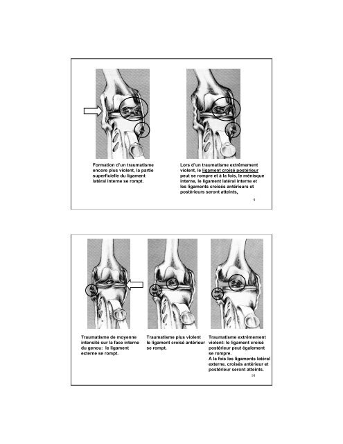 Le genou et le ligament croisé postérieur Figure 111 : Structures du ...