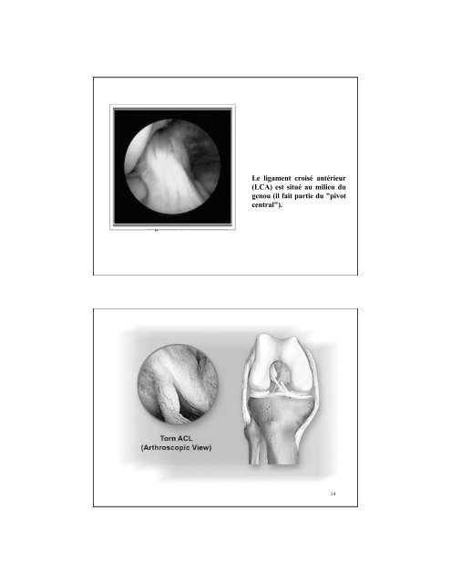 Le genou et le ligament croisé postérieur Figure 111 : Structures du ...