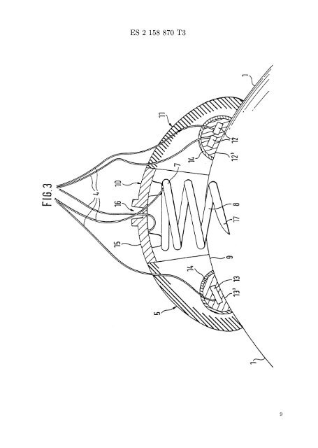 dispositivo sensor para la medicion de parametros vitales de un feto ...